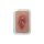 Pocketwound Ulcer - Chronic Wound - clean wound, light