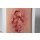 Pocketwound Ulcer - Chronic Wound - clean wound, light