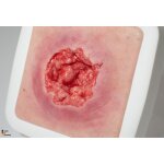 Frame Model Pressure Ulcer with Smooth Wound Edge - clean wound, light