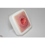 Frame Model Pressure Ulcer with Smooth Wound Edge - clean wound, light