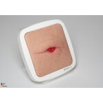 Rahmenmodell Stoma in einer Hautfalte - hell
