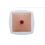 Rahmenmodell Stoma Perfekt - hell