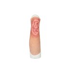 Sleeve Bein mit Ulcus Cruris -  saubere Wunde, hell