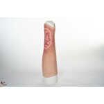 Sleeve Bein mit Ulcus Cruris -  saubere Wunde, hell