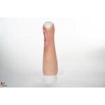 Sleeve Bein mit Ulcus Cruris -  saubere Wunde, hell