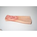 Sleeve Bein mit Ulcus Cruris -  saubere Wunde, hell