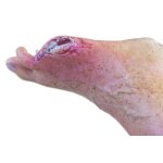 Base model leg with 7 deep wounds