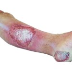 Base model leg with 7 deep wounds