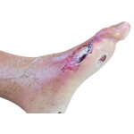Base model leg with 7 deep wounds