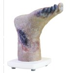 Necrotic foot model