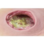Fibrin-Imitat