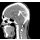 Head and neck phantom for CT, X-ray and radiation therapy