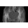 Becken-Phantom mit Coxarthrose für CT, Röntgen und Strahlentherapie