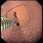 Gastroskopie-Simulator SimStar Gastro ÖGD