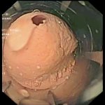 Gastroskopie-Simulator SimStar Gastro ÖGD
