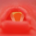Schwieriges Atemwegsmanagement Simulator - Torso