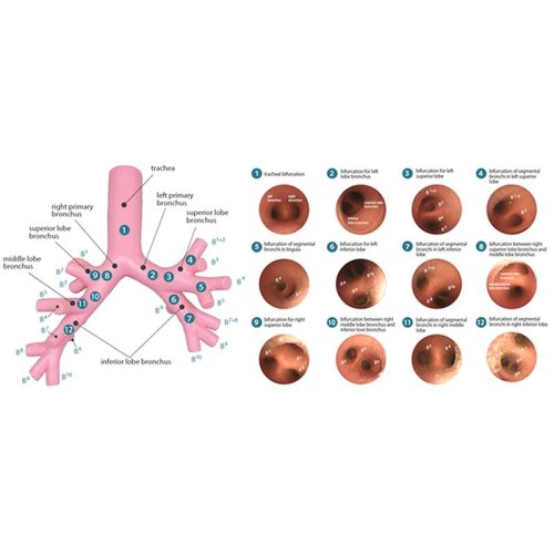 Option Bronchofiberscopy for Difficult Airway Management Simulator Torso
