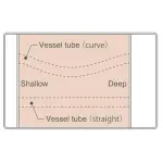 Introductory Ultrasound Training Blocks