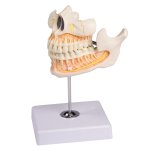 Decidous teeth model