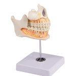 Decidous teeth model