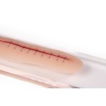 OP Wunde, 22cm