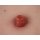 Wound Moulage Ileostoma, incl. stand