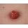 Wundmoulage Ileostoma, inkl. Stativ