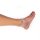 Wound foot with diabetic foot syndroms