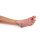 Wound foot with diabetic foot syndroms