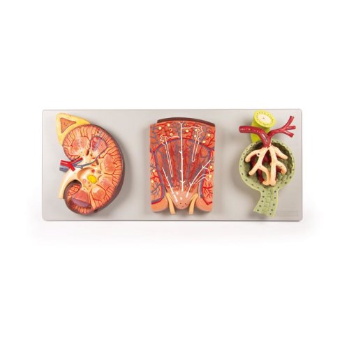 Nierenschnitt, Nephron und Nierenkörperchen