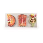 Nierenschnitt, Nephron und Nierenk&ouml;rperchen