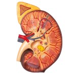 Nierenschnitt, Nephron und Nierenkörperchen