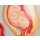 Fetal development