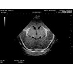 Neonatales Ultraschall-Übungsphantom Kopf