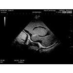 Neonatales Ultraschall-Übungsphantom Kopf