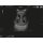 Ultrasound Neonatal Head Phantom with Hydrocephalus