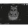 Ultrasound Neonatal Head Phantom with Hydrocephalus