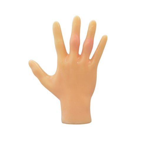 Rheumatisches Fingerphantom