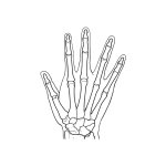 Rheumatisches Fingerphantom