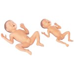 Premature Infant Model