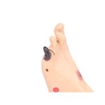 Wilma Wound Foot