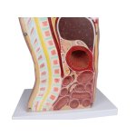 NG-Sonden- und Tracheostomie Torso lebengroß