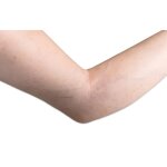 Base model arm without wounds