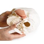 Schädelmodell für Zahnmedizin mit CMD Syndrom, 8-teilig