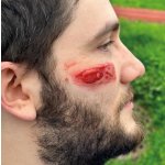 Wound moulage protruding small intestines
