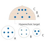 Breast biopsy model (Set)