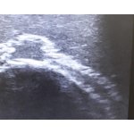 Ultraschall Gesicht