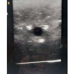 Ultrasound regional anaesthesia simulator