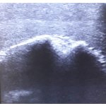 Ultrasound Training Shoulder