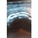 Ultrasound Training Shoulder